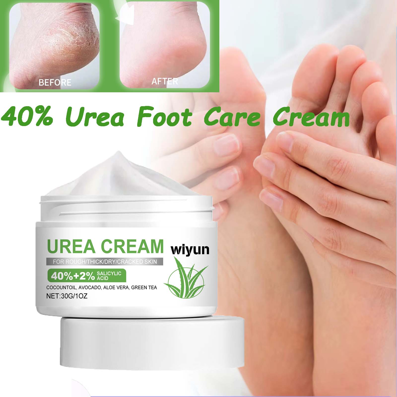 Urea Foot Cream - 40% Urea Foot Care Cream Overnight