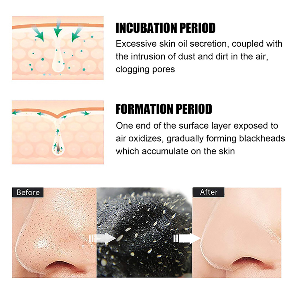 10/20/50/100PCS Nose Blackhead - Charcoal Pore Strip review and price