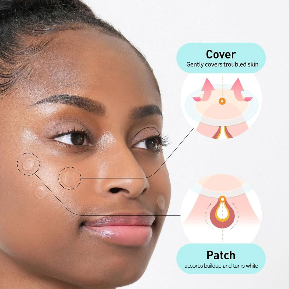 Olive Young Care Plus Spot Cov - Skincare Acne review and price
