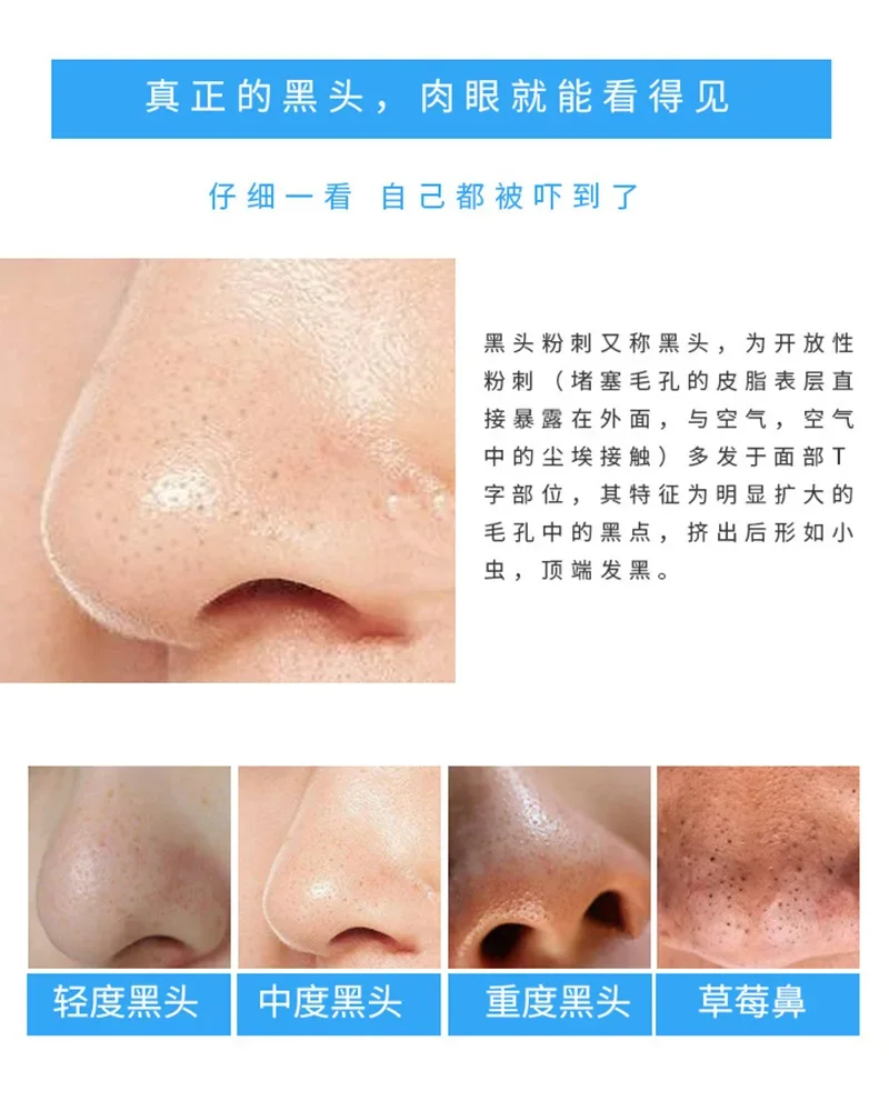 30 Pcs Bamboo Charcoal Nose St - Charcoal Pore Strip review and price