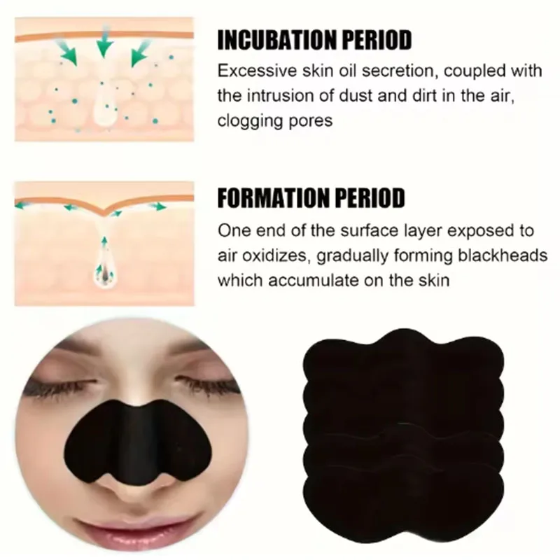 10/20/50Pcs Charcoal Blackhead - Charcoal Pore Strip review and price